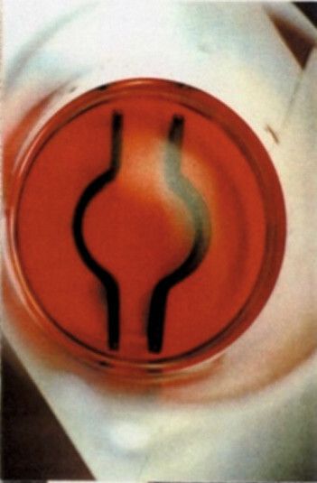 Bild 4: … wurden in ein biologisches Entrostungsbad gegeben. Anschließend … (Kunz)