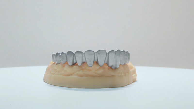 Die individuelle Anpassung von Zahnersatz an patientenspezifische Anforderungen, ist ein herausragender Vorteil von 3D-Metalldruck. Funktion und Tragekomfort für die Patienten können damit stark verbessert werden. (Coherent)