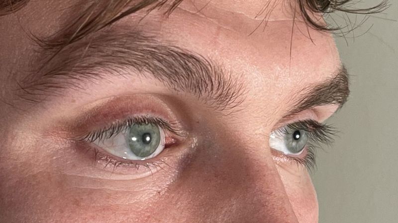 Das künstliche rechte Auge, im Bild links zu sehen, ist kaum vom echten zu unterscheiden: Die mit Technologien des Fraunhofer IGD im 3D-Druckverfahren hergestellten Augenprothesen überzeugen in Erscheinung und Form.  (Bild: Stephen Bell, Ocupeye Ltd)