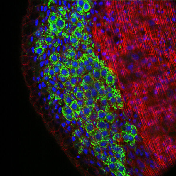 Ein mikroskopischer Blick in den Tumor von Hydra. Blau: Zellkerne der Tumorstammzellen. Grün: Marker für Stammzellen, die für die Geschlechtsdifferenzierung vorprogrammiert sind. Rot: Zytoskelett der Zellen. (Bild: Anton-Erxleben)
