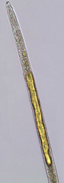 Mikroskopische Aufnahme eines Fadenwurms Radopholus similis: Die Fetttröpfchen sind zusammengeflossen und verdrängen die inneren Organe des Wurms. (Bild: S. Dhakshinamoorthy, Universität Löwen)