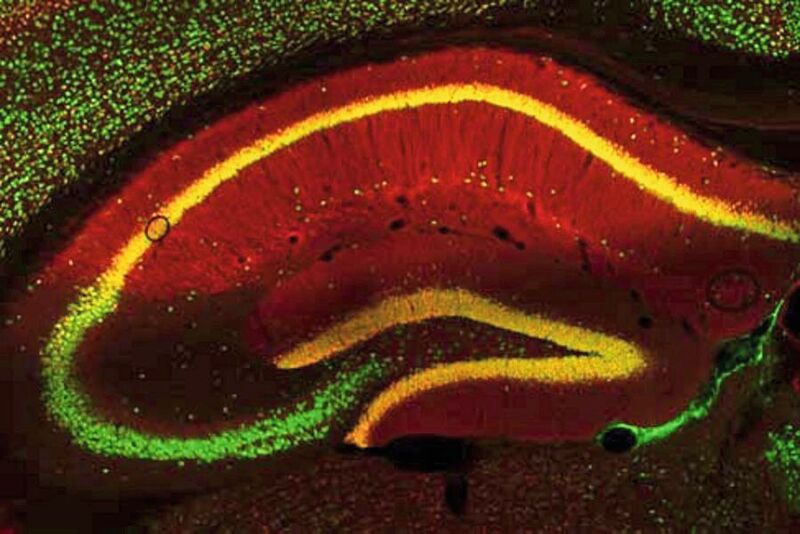 In Mäusegehirnen haben Forscher einen Signalweg entdeckt, der Übergewicht begünstigt. Die Nervenzellen des Mäusegehirns sid hier grün und das menschliche Protein PRG-1 rot dargestellt. Wenn die Nervenzellen PRG-1 enthalten erscheinen die Zellen in gelb.