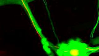 Zebrafisch-Nerven die mit dem Gehirn verschaltet sind (grün). Eines dieser Neuronen trägt ein durch Licht aktivierbares Enzym (rot). Wissenschaftler konnten die Regeneration von verletzten Neuronen mit Hilfe von optogenetischen Methoden stimulieren. (Bild: Helmholtz Zentrum München)