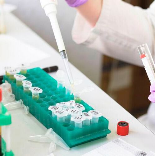 As the dual-inhibition mechanism of the novel drug is highly feasible in a clinical setting, the researchers are now looking to develop a soluble analogue of the drug so that it can eventually be administered to patients. As the dual-inhibition mechanism of the novel drug is highly feasible in a clinical setting, the researchers are now looking to develop a soluble analogue of the drug so that it can eventually be administered to patients.