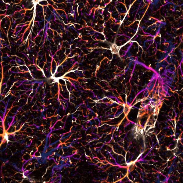 Gedächtnis-Netz  Im zentralen Nervensystem bilden so genannte Astrozyten große Netzwerke aus miteinander verbundenen Zellen. Neurowissenschaftler der Universität Zürich haben im Tierexperiment gezeigt, dass dieses Netzwerk essenziell für räumliches Lernen und die Gedächtnisbildung ist. Denn wenn diese Verbindungen im Gehirn erwachsener Mäuse unterbrochen sind, können die Tiere keine räumlichen Informationen mehr speichern. Das Bild zeigt einen Ausschnitt des Netzwerks von Astrozyten im Hippocampus einer Maus unter dem Fluoreszenzmikroskop. Hier gehts zur Originalmeldung Wissenschaftsbild des Tages vom 10.3.2022 (Ladina Hösli, UZH)