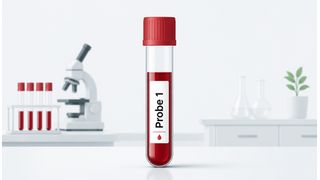 Per Blutprobe ermöglicht der NfL-Test von Roche den Nachweis von Neuroinflammation bei Multipler Sklerose – Symbolbild (Bild: GPT Image Editor / KI-generiert)