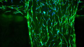 In the PhysioINK project, Fraunhofer researchers are developing bio-printing inks from the most common tissue proteins. Under the microscope, the living tissue cells (fibroblasts) are visible in the printed lattice structure: blue represents the cell nucleus, and green represents the cytoskeleton. (Source: Tobias Weigel/Fraunhofer ISC)