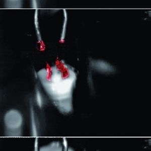 Bild 2: Ein zeitlich ungünstig dosierter und damit fehlender Elektrolyttropfen verändert nicht nur die Batterieeigenschaften sondern verschmutzt auch die Produktionsanlage und erhöht den Wartungsaufwand. Schnell konnte man mit Hilfe der Zeitlupenstudien die entsprechenden Prozessparameter optimal einstellen.