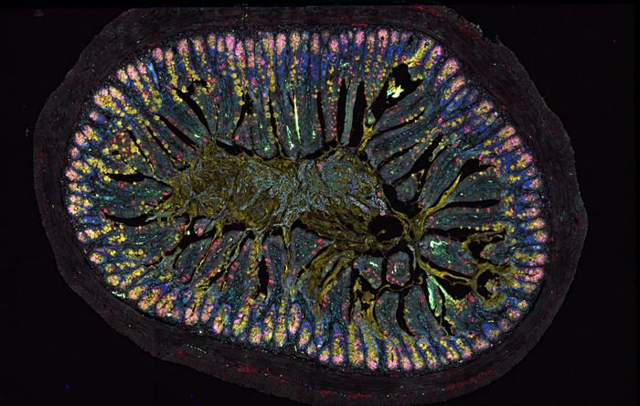 Die Rolle des „Darmgehirns“ Das Darmgehirn beeinflusst über den Botenstoff VIP die Zusammensetzung der Darmbarriere. Fehlt VIP, treten an der Darmoberfläche bestimmte Zelltypen häufiger auf, wie dieser Gewebeschnitt (Mausmodell) zeigt: Tuftzellen (rot), schleimbildende Becherzellen (gelb), Paneth-Zellen (pink) und Stammzellen (grün).  Dies hat ein internationales Team um die Charité und die Uni Bern herausgefunden. Das „Darmgehirn“ steuert die Darmbarriere, die den Körper vor Keimen und schädlichen Stoffen schützt.   Wichtiger Schlüssel ist der Botenstoff VIP. Damit sprechen Darmnerven direkt mit Darmstammzellen und bremsen deren Wachstum und Entwicklung. Fehlt VIP, entstehen zu viele Tuftzellen. Diese schicken Signale, die allergieähnliche Reaktionen im Darm auslösen können. So wirkt das Darmnervensystem wie ein Dirigent zwischen Stammzellen und Abwehrzellen und hilft, die Darmschleimhaut stabil zu halten.   Die Erkenntnisse eröffnen neue Möglichkeiten für gezieltere Behandlungen bei Allergien, Reizdarm und chronisch entzündlichen Darmerkrankungen. Außerdem deutet vieles darauf hin, dass die Ernährung diese Nerven-Darm-Achse beeinflussen kann. Das will das Team als Nächstes untersuchen.  Hier gehts zur OriginalmeldungWissenschaftsbild des Tages vom 02.12.2025  (Bild: Charité | Luisa Barleben)