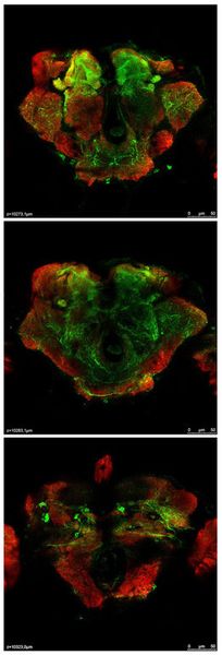 Abb. 2: Bei an Parkinson erkrankten Fliegen (im Bild: ein Teil eines Gehirns) verbesserte sich die Motorik nach dem Ausschalten eines Kalzium transportierenden Proteins. (Bild: Karl-Franzens-Universität Graz)
