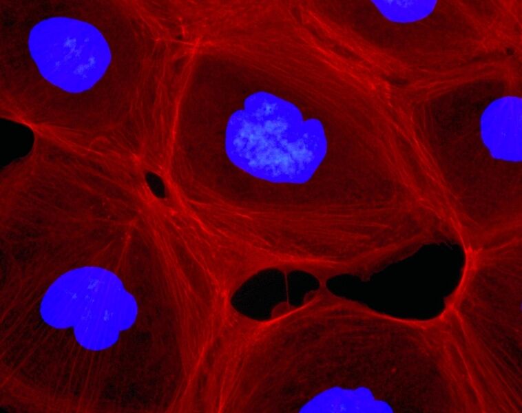 Abb. 1a Fluoreszenzmikroskopische Aufnahmen des Effektes von Chivosazol F (12, 50 ng/mL) auf die F-Actin Organisation in Hautkrebszellen des Typs A 431: vor der Behandlung. F-Actin ist mit Phalloidin (rot) und die Zellkerne mit DAPI (blau) gefärbt. (Archiv: Vogel Business Media)