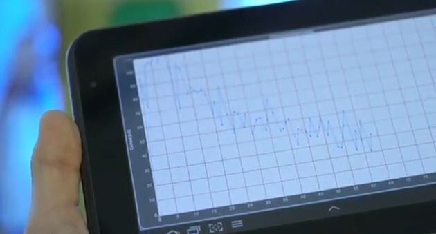 Bei Patienten mit chronischen Krankheiten, könnte der Chip Warnungen senden, noch bevor Symptome auftreten. (Bild: epfl.com)