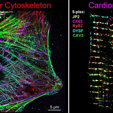 Abb. 1: Fünffach-multiplexierte DNA-PAINT-Super-Resolution-Aufnahme mit automatisiertem mikrofluidischem Lösungswechsel. (Bild: III. Physikalisches Institut Biophysik, Universität Göttingen; Adaptiert nach Basak et al., ACS Nano 20 (2026), unter der Lizenz CC BY 4.0)