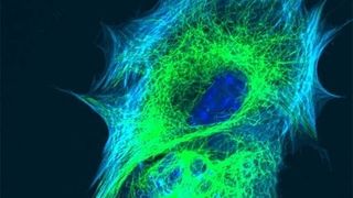 Intrazelluläre Transportvorgänge sind für das Überleben von Zellen entscheidend. (Archiv: Vogel Business Media)