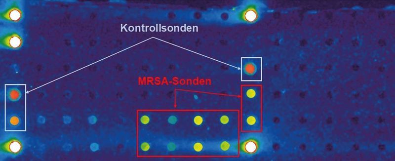 Abb. 3: Falschfarbendarstellung eines Microarrays nach der Hybridisierung entsprechend des in Tabelle 1 beschriebenen Protokolls auf der mikrofluidischen Kartusche. (Biflow Systems/Fraunhofer IZI-BB)