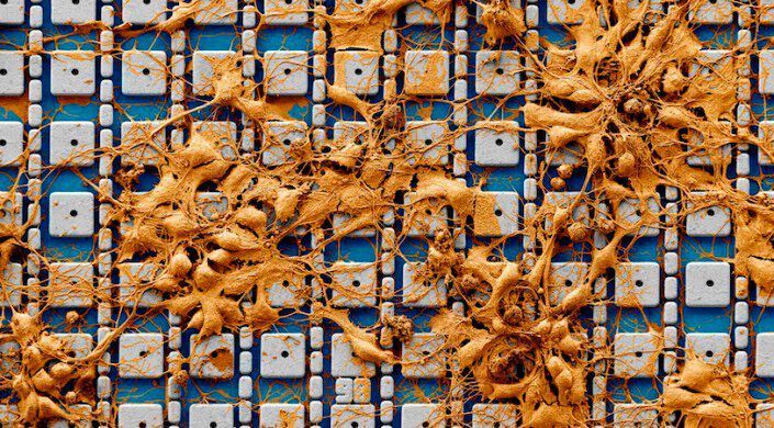 False colored scanning electron microscope image of neurons cultured on top of the electrode array. Actual recording experiments are performed with much higher neuron densities containing three to six cell layers covering the entire electrode array. (Harvard SEAS)