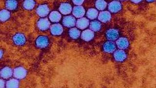 Das Polio-Virus, Erreger der auch als Kinderlähmung bezeichneten Poliomyelitis (Bild: Dennis Kunkel Microscopy, Inc.; Quelle: theguardian)