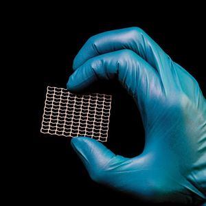 Kraniale Netzimplantate aus Titan erfordern gratfreie Kanten, die mit anderen Herstellungsverfahren schwieriger zu erreichen sind als mit der Ätztechnik.