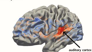 Auditive Reize werden vorwiegend in der hier rot dargestellten Region der Hirnrinde verarbeitet. (Rémi Gau)
