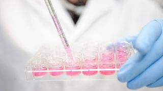 Im Projekthaus Tissue Engineering arbeiten Wissenschaftler daran, verlässliche Lösungen für die Regeneration von Gewebe etwa nach Unfällen oder Krankheiten zu ermöglichen. (Frank Preuss/Evonik)