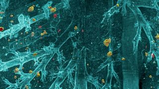 DeepMACT nutzt künstliche Intelligenz, um selbst kleinste Metastasen im gesamten Mauskörper zu erkennen. Im Bild sind einzelne disseminierter Zellen in der Lunge zu sehen.  (©Helmholtz Zentrum München)