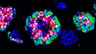 Menschliche Langerhans Inseln, mit 10 mM Artemisinin behandelt und immunofluoreszent gefärbt: Zellkern (blau), ARX (weiß), Glukagon (rot) und C-Peptid (grün) (Medizinische Universität Wien)
