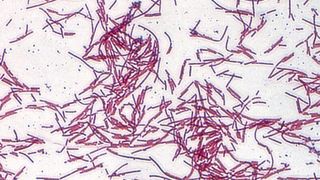 Lichtmikroskopische Aufnahme von Clostridium ramosum nach Gram-Färbung (Tina Jaenicke/DIfE)