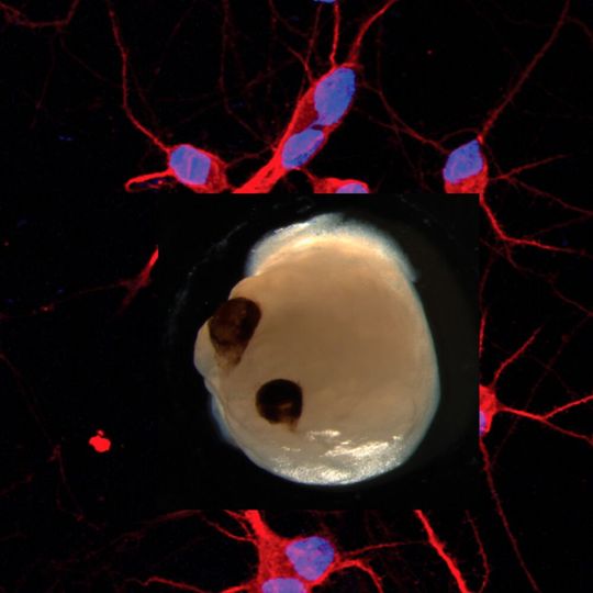 Deutlich sichtbar: Jay Gopalakrishnan und seinem Team gelang es, augenähnliche Strukturen auf einem Hirnorganoid aus Stammzellen zu erzeugen. Deutlich sichtbar: Jay Gopalakrishnan und seinem Team gelang es, augenähnliche Strukturen auf einem Hirnorganoid aus Stammzellen zu erzeugen.