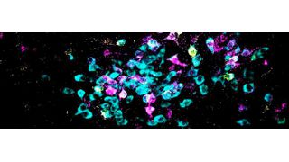 New research published in Science identifies the brain biochemistry and neural circuitry that cause generalized fear experiences. Here, neurons are shown in cyan and retrograde tracers shown in yellow and magenta. (Source: Spitzer Lab, UC San Diego)