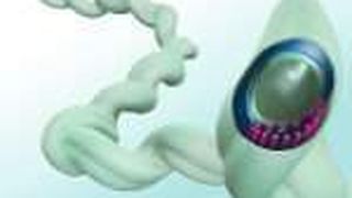 Das Bakterium Borrelia burgdorferi ist der Krankheitserreger der Borreliose. Neue Kits zur Borrelien-Diagnostik erlauben den schnellen Nachweis des Erregers.  (Bild: Qiagen)