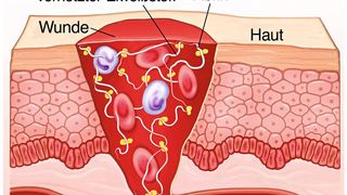 Die Blutgerinnung ist ein überlebenswichtiger Vorgang nach einer Verletzung. Dabei verkleben Blutplättchen (gelb) und Fibrinfasern die Blutzellen (weiße und rote Blutkörperchen) zu einem Pfropfen, der die Wunder schließt. (Bild: Henrie - stock.adobe.com)
