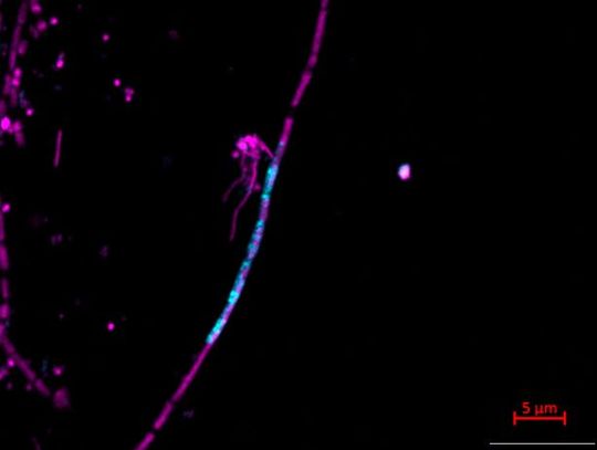 Fluoreszenzmikroskopische Aufnahme der RNA eines springenden Gens (türkis) innerhalb von Zellen von Methanothrix soehngenii (violett). Die RNA stammt von dem räuberischen Bakterium Candidatus Velamenicoccus archaeovorus und zeigt, das Introns zwischen verschiedenen Mikroorganismen in der Form von RNA übertragen werden können.(Bild:   Jens Harder / Max-Planck-Institut für Marine Mikrobiologie)