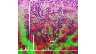 Ein neues Protokoll für die bildgebende Massenspektrometrie erlaubt die Analyse von Stoffwechselprodukten wie Adenosinmonophosphat aus fixiertem Gewebe, hier im Hintergrund dargestellt. (Helmholtz Zentrum München)
