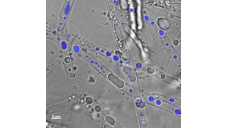 Abb. 1: Mikroskopische Aufnahme des Myzel-bildenden Boden Mikroorganimus Pythium ultimum welcher Phenanthren in seinem Zellinnern transportiert: Overlay eines Durchlicht- und Fluoreszenzbildes von Pythium ultimum, dessen Hyphen Phenanthren-angereicherte Vesikel (in blau) enthalten. (Bild: Susan Foß/UFZ)
