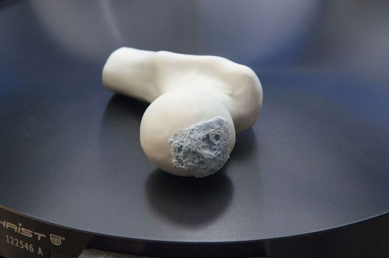 Individuell angepasste Implantate, die vollständig in den Körper integriert und langfristig durch eigene Knochensubstanz ersetzt werden: Möglich wird dies durch eine am Fraunhofer-Institut für Keramische Technologien und Systeme IKTS entwickelte keramische Material- und Verfahrenskombination.  (Fraunhofer IKTS)