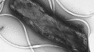 Helicobacter pylori ist ein Bakterium, das sich beim Menschen im Magen einnistet. (Bild: Yutaka Tsutsumi)