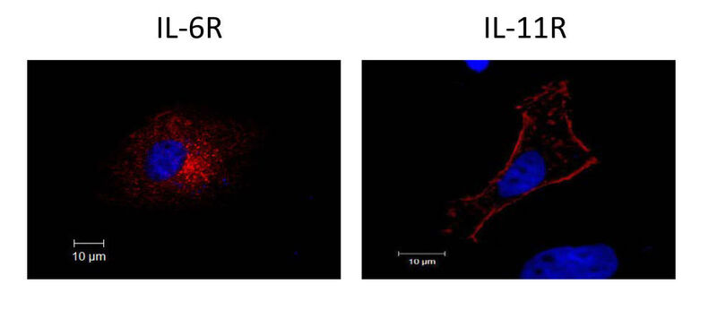 Fluoreszenzmikroskopische Aufnahme der Rezeptoren von Interleukin-6 (IL-6R) und Interleukin-11 (IL-11R). Während der IL-11R nach Aktivierung der Protease ADAM17 auf der Zelloberfläche verbleibt und an der Plasmamembran die ganze Zelle umrandet (rechtes Bild), ist der IL-6R vollständig von der Zelloberfläche verschwunden (linkes Bild). Blau: Zellkern. (Bild: Niloufar Monhasery, Uni Kiel)