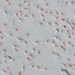 Abb.2: Ergebnis einer automatischen Zelldetektion.