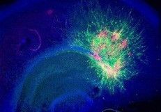 Die Verteilung von Neuronen und Nervenvorläuferzellen in Abwesenheit des Hemmstoffs BIBF (Bild: Nature Neuroscience)
