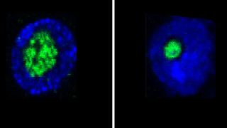 Längerlebige Fruchfliegen (rechts) haben kleinere Nukleoli als ihre kürzer lebenden Verwandten (links).  (MPI f. Biologie des Alterns/ V. Tiku)