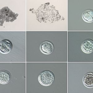 (Cesare Galli, Avantea)