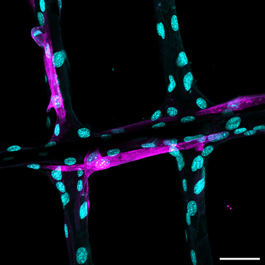 Muskelzellen auf den MEW-Gerüsten. Blau zeigt den Muskelzellkern (DAPI), während Rosa die Muskelzellstreifen (Alpha-Actinin) zeigt.(Bild:)