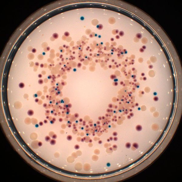 In dieser Wasserprobe aus der Nordsee sind verschiedene Vibrionen-Spezies vertreten, wie die unterschiedliche Färbung der Verdünnungsreihe von Anreicherungskulturen auf selektivem Vibrio Chromaga zeigen. (Alfred-Wegener-Institut / Antje Wichels)