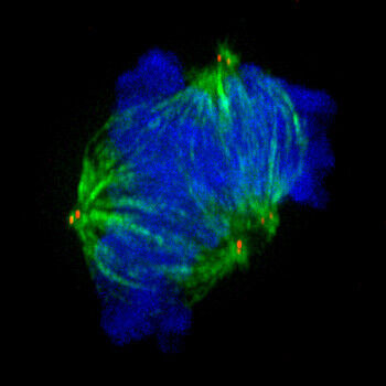 Fehlerhafte Teilung der Chromosomen (blau) mit mehreren Zentrosomen (rot) an einer multipolaren Spindelapparat (grün). (Bild: Universität Basel)
