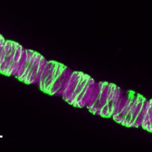 Evolutions-Profi Cyanobakterium

Photosynthetische Bakterien spielten eine entscheidende Rolle in der Geschichte der Erde. So produzierten Cyanobakterien Sauerstoff und ermöglichten dadurch komplexes Leben. Forschende am Institute of Science and Technology Austria (ISTA) haben nun ein „Evolutions-Update“ der kleinen grünen Mikroorganismen entdeckt: ein Protein-System, das im Laufe der Zeit seine Aufgabe verändert hat – von der Trennung der DNA hin zur Formgebung der Zelle. Die Studie zeigt, wie sich solche Proteinsysteme weiterentwickelten und so zur Entstehung der Multizellularität bei Cyanobakterien beitrugen.

Das Bild zeigt so genannte CorM-Filamente(grün) in Anabaena. Das violette Signal entspricht den photosynthetischen Pigmenten der Cyanobakterien. 


Hier gehts zur Originalmeldung
Wissenschaftsbild des Tages vom 21.4.2026 (Bild: Springstein et al./Science)