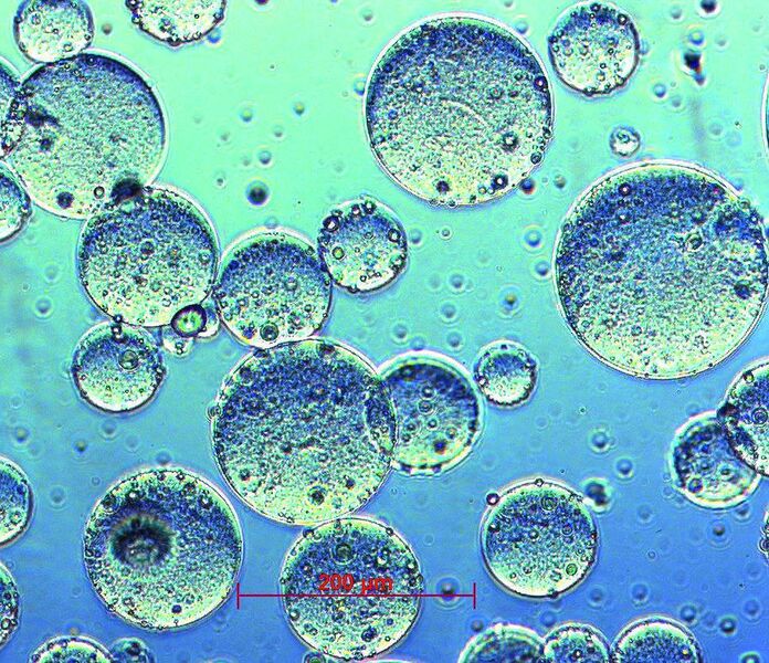 Abb. 3: Mikroskopische Aufnahme (100x) von frisch hergestellten Mikrokapseln aus TGase-induzierten Caseingelen. Der mittlere Durchmesser liegt bei etwa 150 µm. (Archiv: Vogel Business Media)