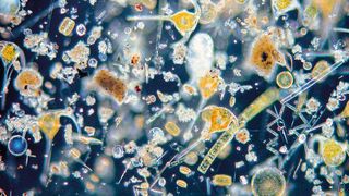 Phytoplankton unter dem Mikroskop (Bild: Annegret Stuhr, Geomar)