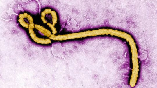 Kolorierte Transmissionselektronenmikroskopaufnahme eines Ebola-Viruspartikels.(Bild:  CDC/Frederick A. Murphy)
