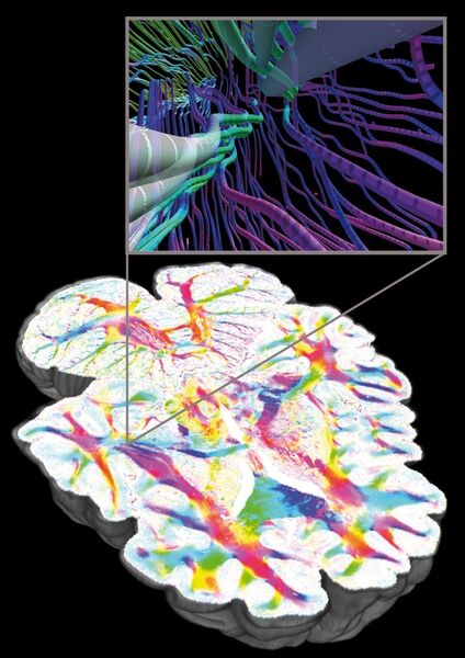 Einblick in das Innere einer 3D-Rekonstruktion eines menschlichen Gehirns. Die unterschiedlichen Farben zeigen verschiedene Verläufe von Nervenfaserbahnen an. Fasern sind die Grundlage von Netzwerken von Nervenzellen, die verschiedene Hirnfunktionen ermöglichen. Mit der am Jülicher Institut für Neurowissenschaften und Medizin (INM-1)entwickelten dreidimensionalen Polarisationsbildgebung (Polarized Light Imaging) ist es möglich, selbst kleinste Faserverbindungen (hier dargestellt als dreidimensionale Röhren oder 