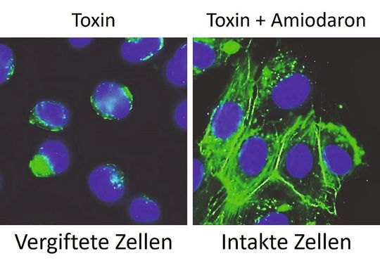 Links: In kultivierten Zellen, die mit dem Clostridioides difficile-Toxin TcdB vergiftet wurden, kollabiert das Zellskelett (in grün) um den Zellkern (in blau) herum. Rechts: In kultivierten Zellen, die zunächst mit Amiodaron behandelt und danach mit dem Clostridioides difficile-Toxin TcdB vergiftet wurden, bleibt das Zellskelett und damit die Morphologie der Zellen intakt.(Bild:  doi: 10.1080/19490976.2023.2256695)